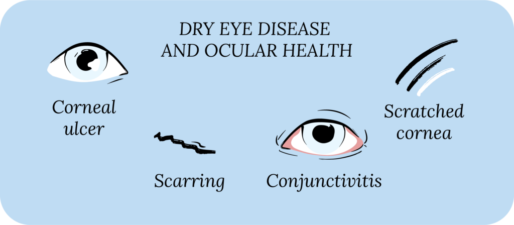The Impact of Dry Eye Disease on Coexisting Ocular Conditions