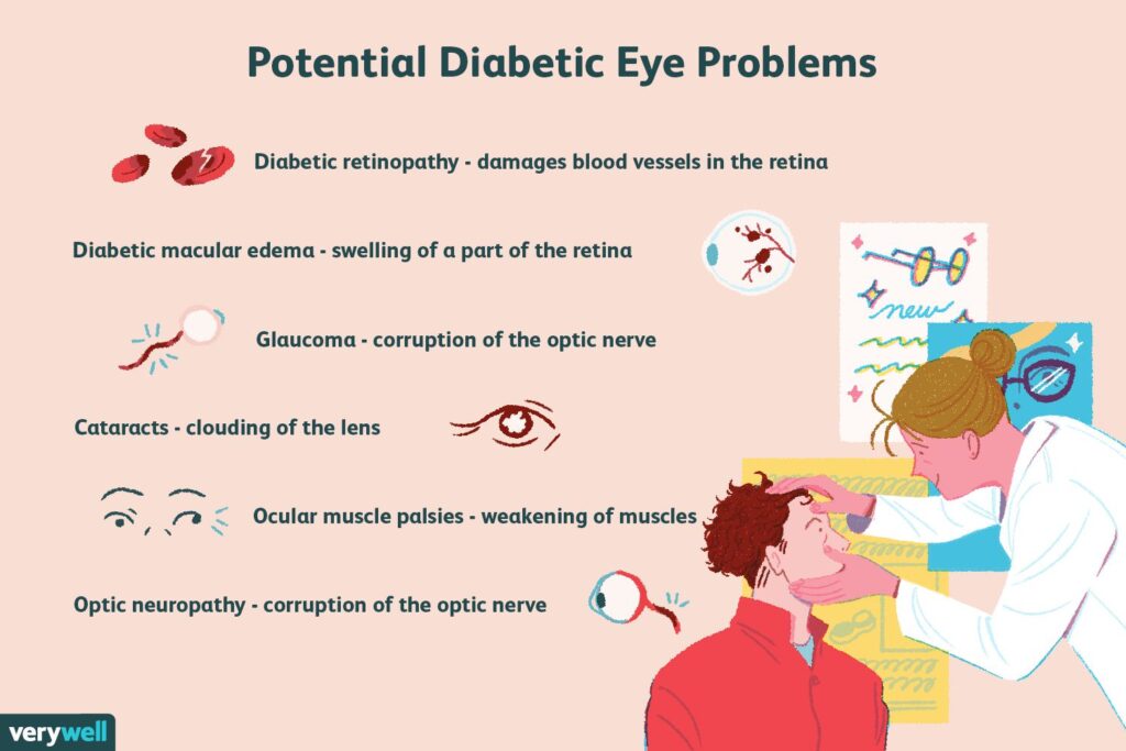 Can Eye Doctor Detect Diabetes